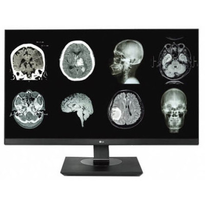 LG Digital Signage Displays Digital Signage Display