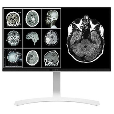 LG Digital Signage Displays Digital Signage Display