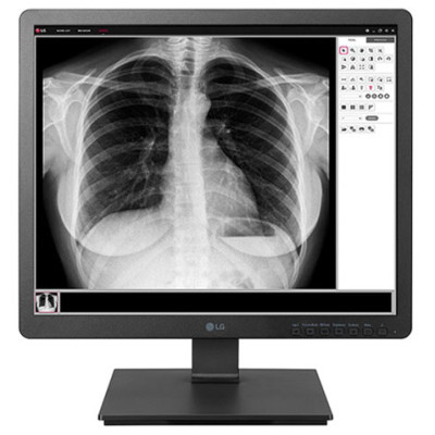 LG Digital Signage Displays Digital Signage Display