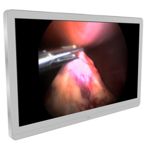 LG Digital Signage Displays Digital Signage Display