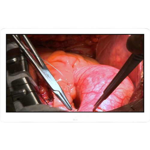 LG Digital Signage Displays Digital Signage Display